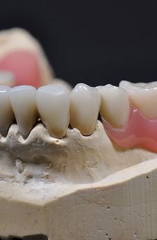 Implant dentaire à Charleroi