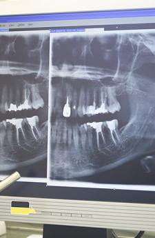 Orthodontie dento-faciale à Charleroi